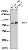 Anti-NPHP1 antibody used in Western Blot (WB). GTX65891