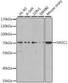 Anti-TR2 antibody used in Western Blot (WB). GTX65892
