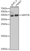 Anti-Wnt7b antibody used in Western Blot (WB). GTX65897