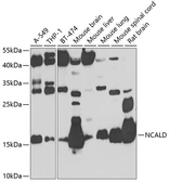 Anti-NCALD antibody used in Western Blot (WB). GTX65899