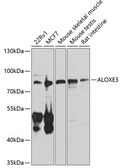 Anti-ALOXE3 antibody used in Western Blot (WB). GTX65902