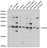 Anti-VPS28 antibody used in Western Blot (WB). GTX65904