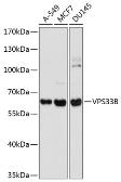 Anti-VPS33B antibody used in Western Blot (WB). GTX65908