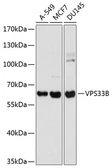 Anti-VPS33B antibody used in Western Blot (WB). GTX65908