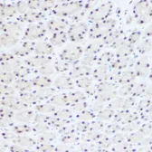 Anti-PRP8 antibody used in IHC (Paraffin sections) (IHC-P). GTX65909