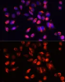 Anti-TIM-3 antibody used in Immunocytochemistry/ Immunofluorescence (ICC/IF). GTX65911
