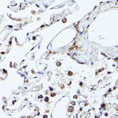 Anti-CD45 antibody used in IHC (Paraffin sections) (IHC-P). GTX65913