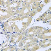 Anti-HS1BP3 antibody used in IHC (Paraffin sections) (IHC-P). GTX65921