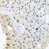 Anti-DNAL1 antibody used in IHC (Paraffin sections) (IHC-P). GTX65922