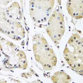 Anti-hnRNP L antibody used in IHC (Paraffin sections) (IHC-P). GTX65923