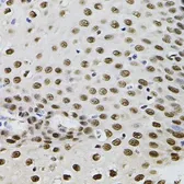 Anti-TFII-I antibody used in IHC (Paraffin sections) (IHC-P). GTX65927