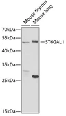 Anti-ST6GAL1 antibody used in Western Blot (WB). GTX65933