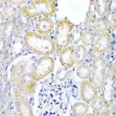 Anti-Rent2 antibody used in IHC (Paraffin sections) (IHC-P). GTX65934