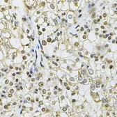 Anti-IFI16 antibody used in IHC (Paraffin sections) (IHC-P). GTX65937
