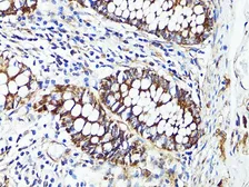 Anti-S100A10 antibody used in IHC (Paraffin sections) (IHC-P). GTX65938