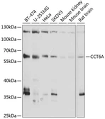 Anti-TCP1 zeta antibody used in Western Blot (WB). GTX65941