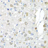 Anti-BAG5 antibody used in IHC (Paraffin sections) (IHC-P). GTX65944