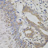 Anti-HTF9C antibody used in IHC (Paraffin sections) (IHC-P). GTX65946