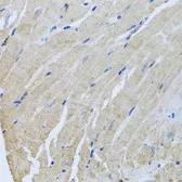 Anti-Sorcin antibody used in IHC (Paraffin sections) (IHC-P). GTX65950