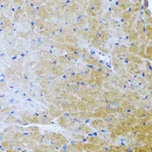 Anti-BMP3 antibody used in IHC (Paraffin sections) (IHC-P). GTX65951