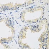 Anti-Rent2 antibody used in IHC (Paraffin sections) (IHC-P). GTX65954