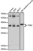Anti-TOB2 antibody used in Western Blot (WB). GTX65957
