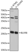 Anti-Flavin reductase antibody used in Western Blot (WB). GTX65958