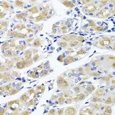 Anti-TSARG2 antibody used in IHC (Paraffin sections) (IHC-P). GTX65960