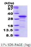 Human WIBG protein, His tag. GTX65961-pro