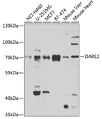 Anti-AspRS antibody used in Western Blot (WB). GTX65963