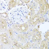 Anti-PDK3 antibody used in IHC (Paraffin sections) (IHC-P). GTX65965