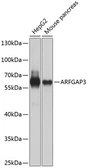 Anti-ARFGAP3 antibody used in Western Blot (WB). GTX65970