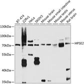 Anti-HPA2 antibody used in Western Blot (WB). GTX65971
