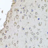 Anti-Hemoglobin alpha 2 antibody used in IHC (Paraffin sections) (IHC-P). GTX65974