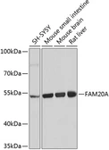 Anti-FAM20A antibody used in Western Blot (WB). GTX65978