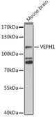 Anti-VEPH1 antibody used in Western Blot (WB). GTX65981