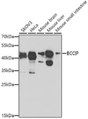Anti-BCCIP antibody used in Western Blot (WB). GTX65987