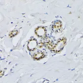 Anti-BCCIP antibody used in IHC (Paraffin sections) (IHC-P). GTX65987