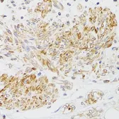 Anti-MYO5A antibody used in IHC (Paraffin sections) (IHC-P). GTX65990