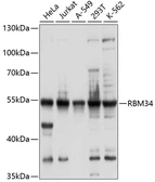 Anti-RBM34 antibody used in Western Blot (WB). GTX66000