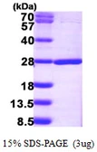Human NUDT16L1 protein, His tag. GTX66002-pro
