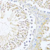 Anti-DDX3Y antibody used in IHC (Paraffin sections) (IHC-P). GTX66004