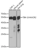Anti-TIM-3 antibody used in Western Blot (WB). GTX66011