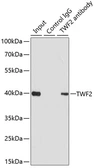 Anti-TWF2 antibody used in Immunoprecipitation (IP). GTX66012