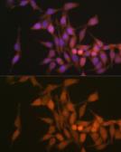 Anti-PSMB6 antibody used in Immunocytochemistry/ Immunofluorescence (ICC/IF). GTX66015