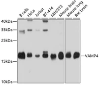 Anti-VAMP4 antibody used in Western Blot (WB). GTX66017