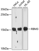 Anti-RBM3 antibody used in Western Blot (WB). GTX66019