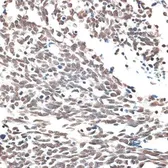 Anti-Aquarius antibody used in IHC (Paraffin sections) (IHC-P). GTX66020