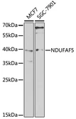 Anti-C20orf7 antibody used in Western Blot (WB). GTX66023