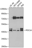 Anti-WDR51A antibody used in Western Blot (WB). GTX66024